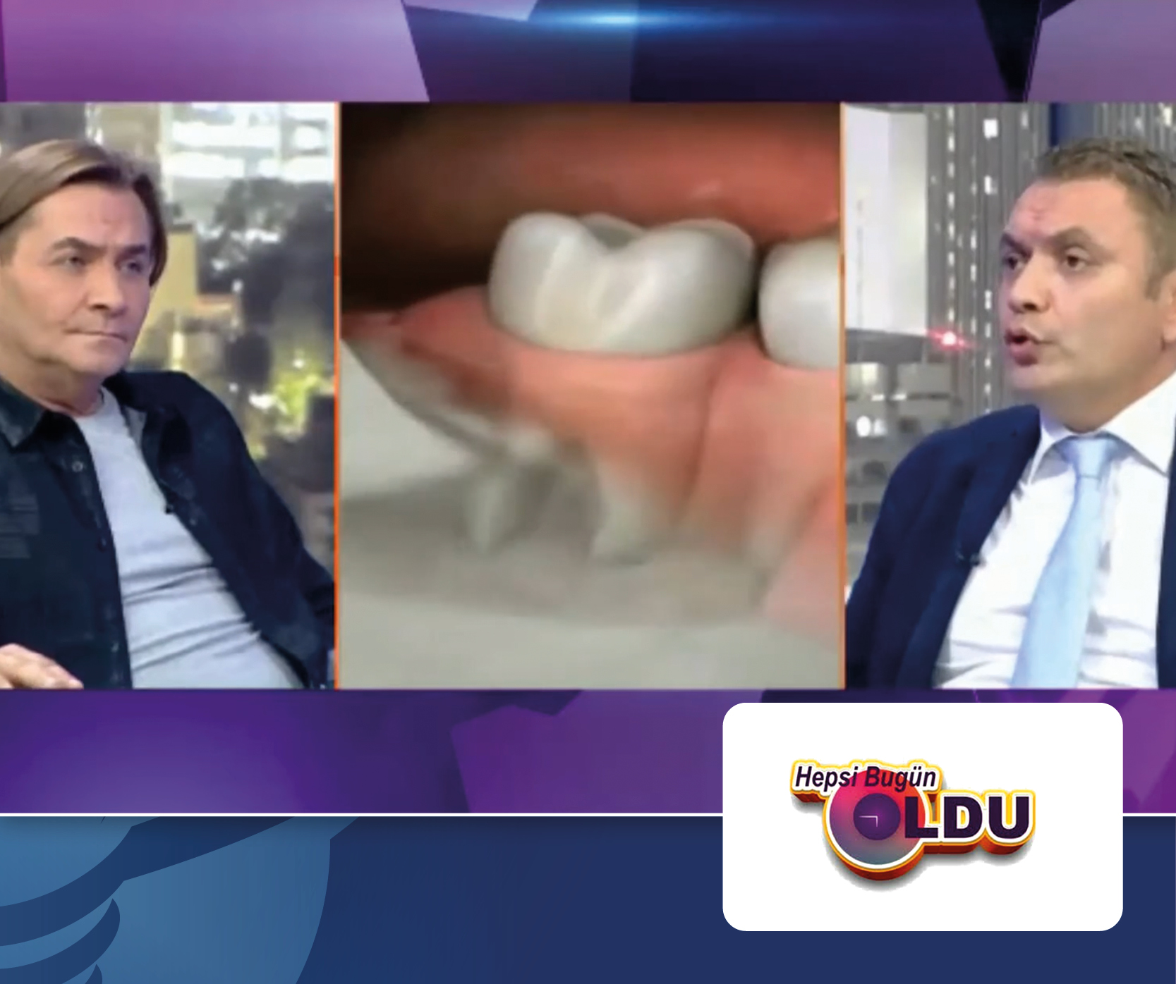 ''Hepsi Bugün Oldu'' Programı