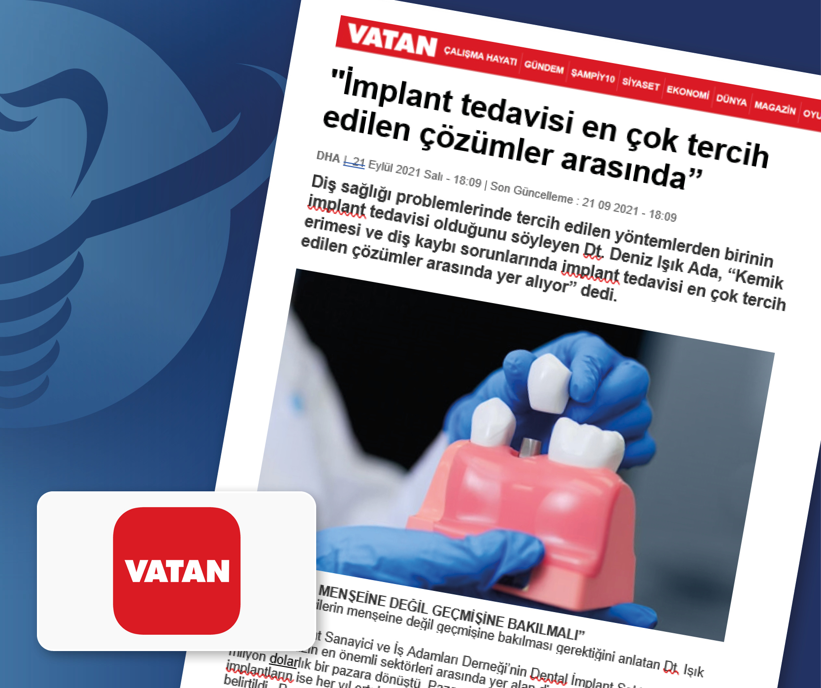 İmplant tedavisi en çok tercih edilen çözümler arasında - Basında İMPLANTDER